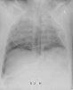 chest_715595.jpg